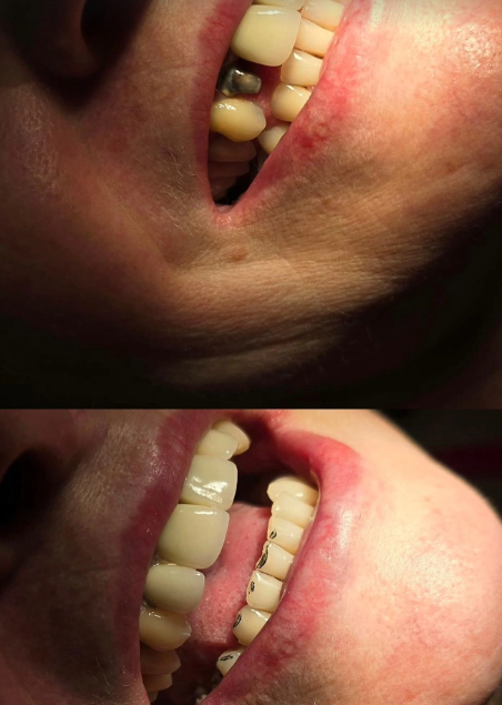 Antes e depois — caso 2